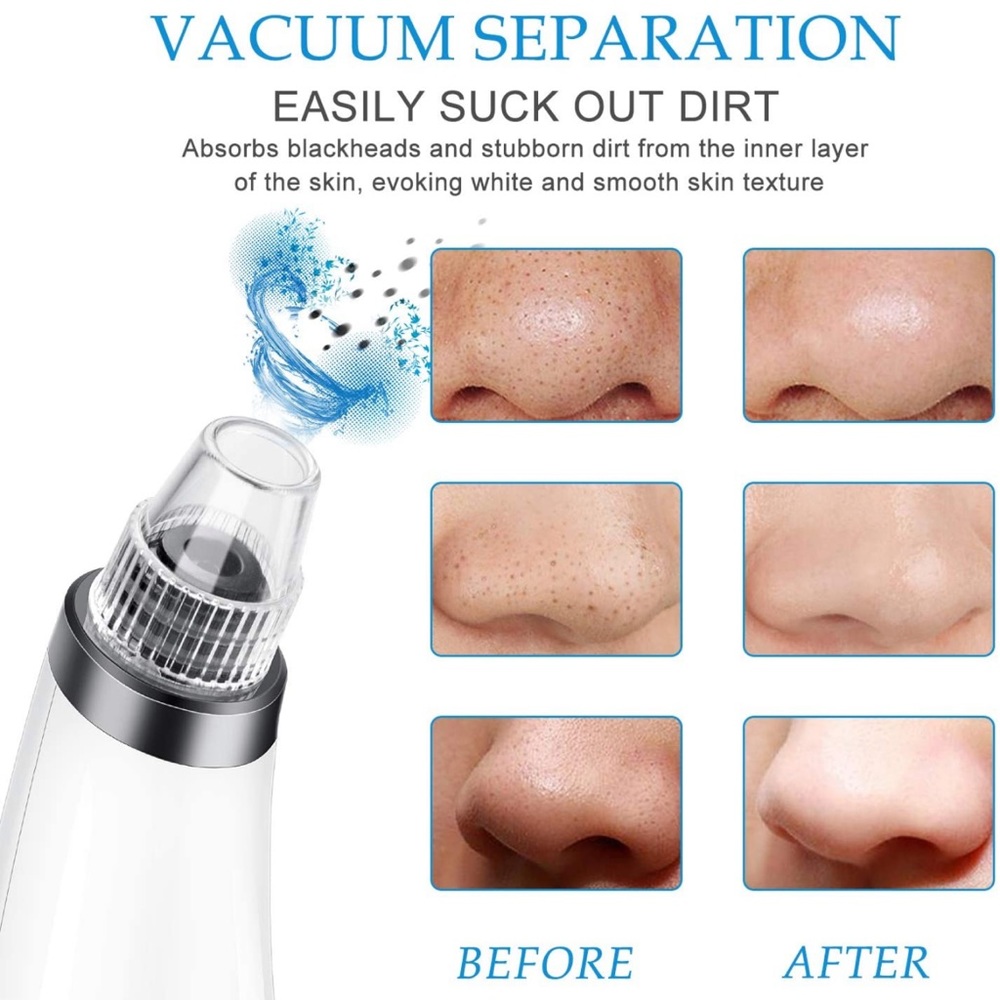 Blackhead Remover Pore Vacuum USB Rechargeable with 5 Suction Probes (White) - Picture 3 of 8